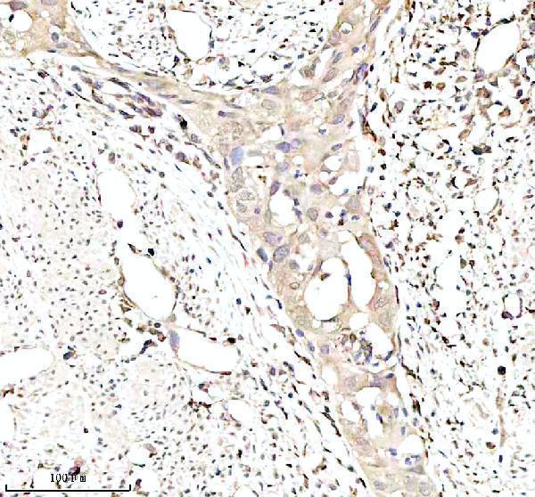 a02010 4 igf2bp2 primary antibodies ihc testing 5