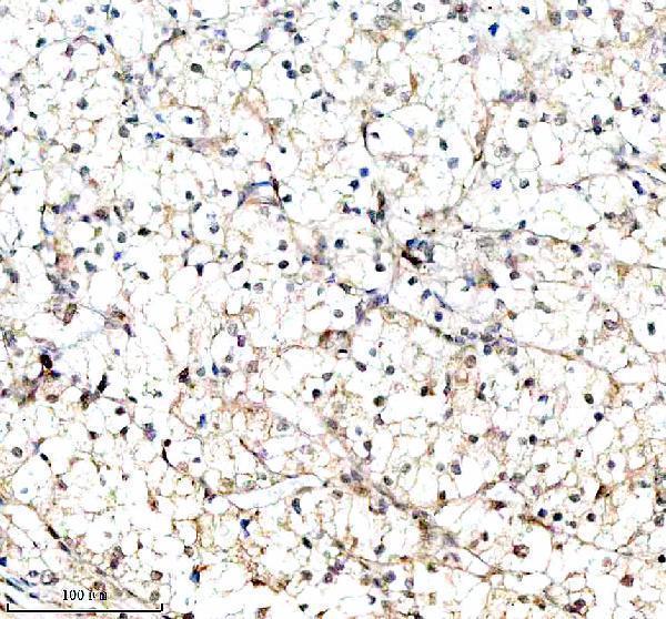 a02010 4 igf2bp2 primary antibodies ihc testing 6
