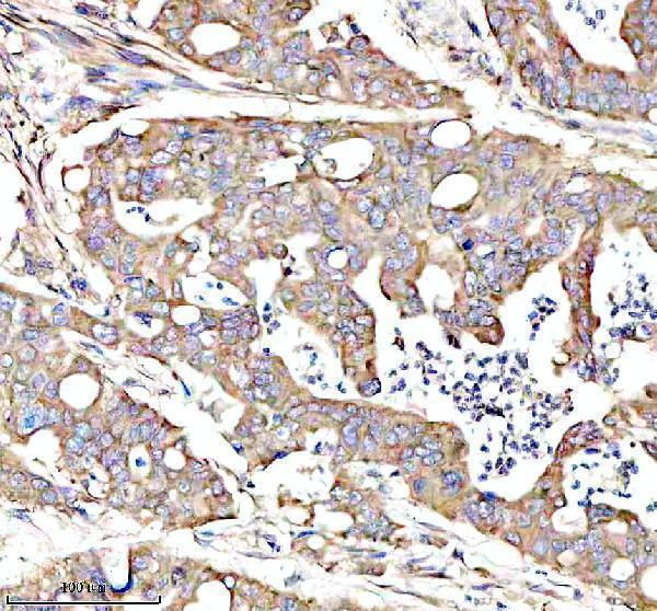 a02010 4 igf2bp2 primary antibodies ihc testing 7