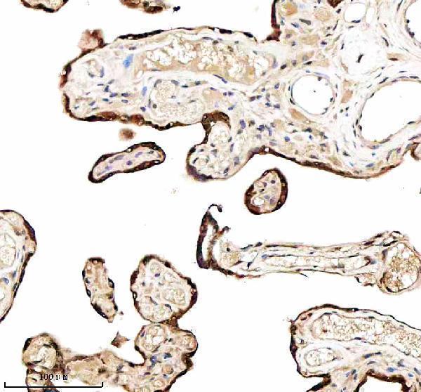 a02010 4 igf2bp2 primary antibodies ihc testing 8