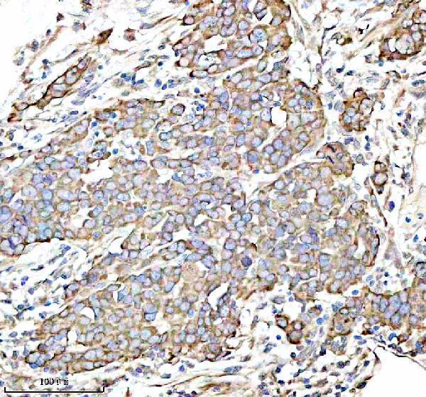 a02010 4 igf2bp2 primary antibodies ihc testing 9