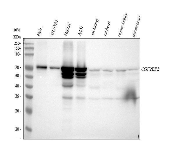  Western blot analysis of IGF2BP2 using anti-IGF2BP2 antibody (A02010-4)