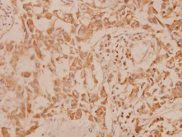 a02011s201 map2k6 primary antiboties ihc testing 2