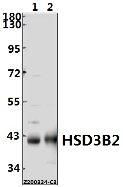 a02012 hsd3b2 primary antiboties wb testing 1