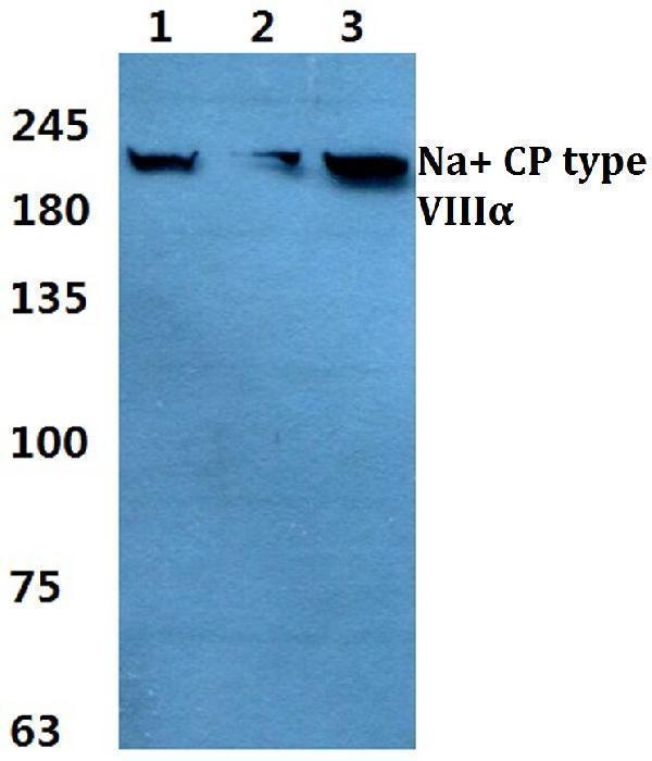 a02015 scn8a primary antiboties wb testing 1_1