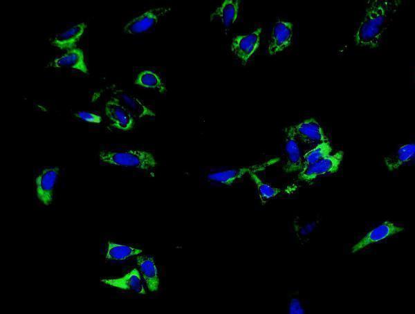 a02016 1 trim6 primary antibodies icc testing 5
