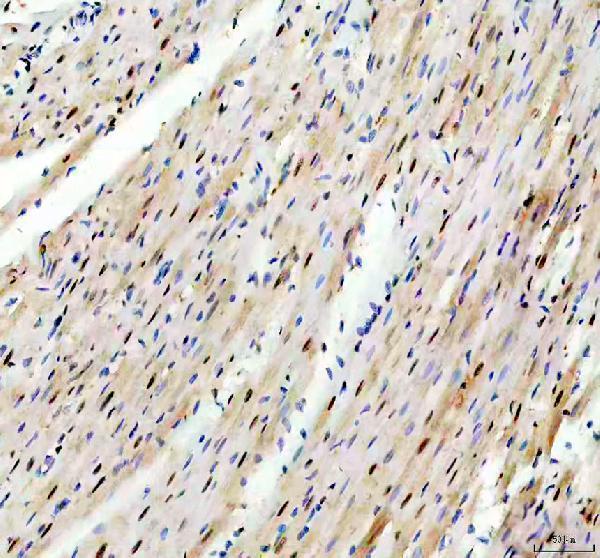 IHC analysis of TRIM63 using anti-TRIM63 antibody (PA1348)