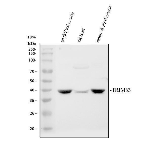 Western blot analysis of TRIM63 using anti-TRIM63 antibody (A02016-2)