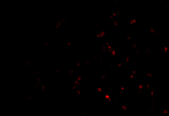 Immunofluorescence of TP-1 in Human Lung cells with TP-1 antibody at 20 μg/mL