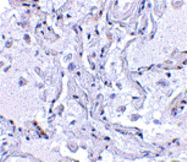 Immunohistochemical staining of human lung tissue using TP1 antibody at 2