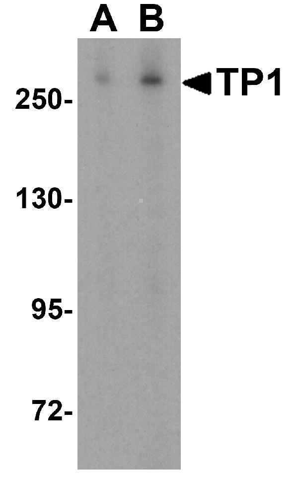 Western blot analysis of TP1 in human kidney tissue lysate with TP1 antibody at (A) 0