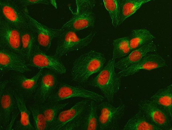 a02018 1 numa1 primary antibodies if testing 6