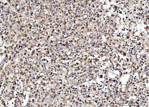  IHC analysis of NUMA/NUMA1 using anti-NUMA/NUMA1 antibody (A02018-1)