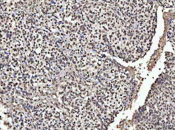  IHC analysis of NUMA/NUMA1 using anti-NUMA/NUMA1 antibody (A02018-1)