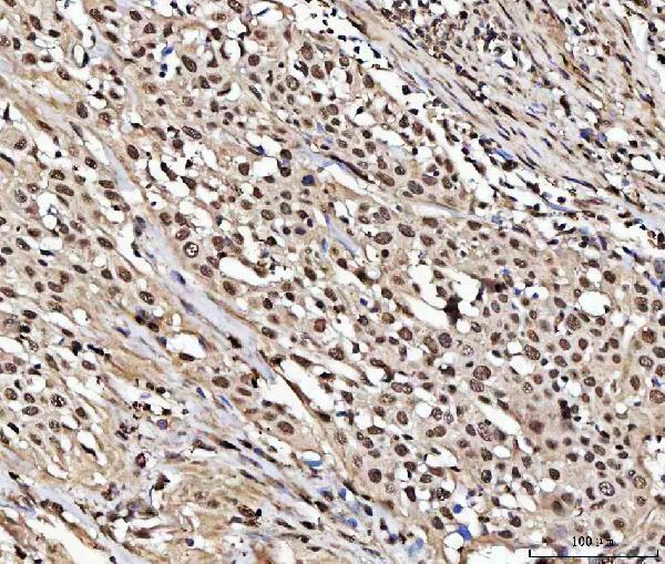 a02018 1 numa1 primary antibodies ihc testing 4