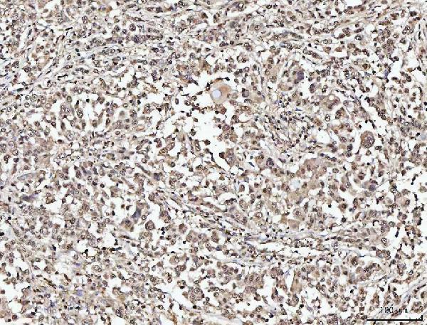 a02018 1 numa1 primary antibodies ihc testing 5