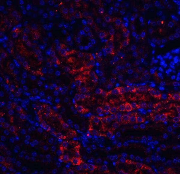 a02019 ddit4 primary antibodies if testing 3