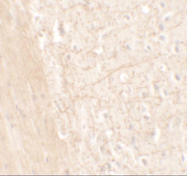 Immunohistochemistry of ERAP1 in mouse brain tissue with ERAP1 antibody at 5 μg/mL