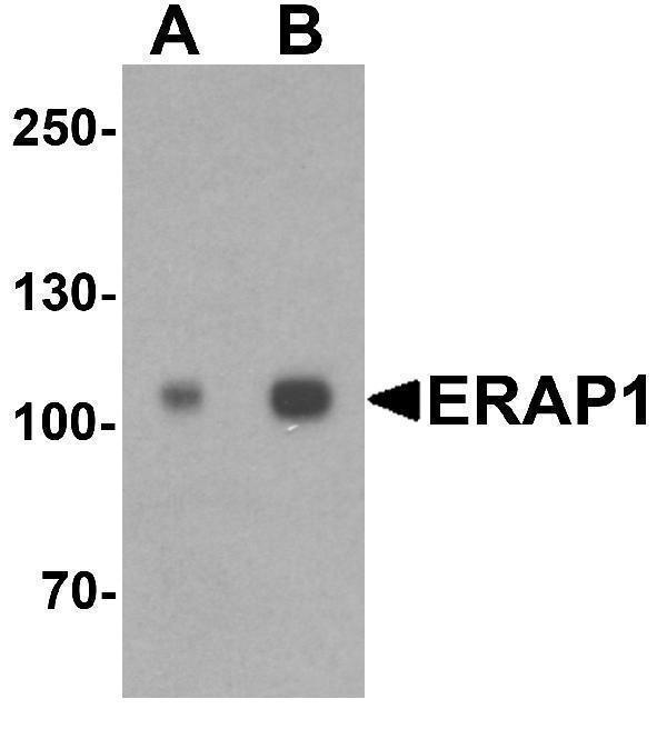 Western blot analysis of ERAP1 in SK-N-SH cell lysate with ERAP1 antibody at (A) 1 and (B) 2 μg/ml