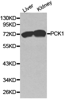 Western blot analysis of extracts of various cell lines, using PCK1 antibody  at 1:1000 dilution