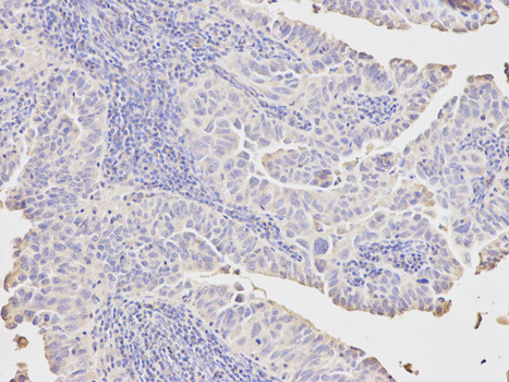a02022 1 pck1 primary antiboties wb testing 2