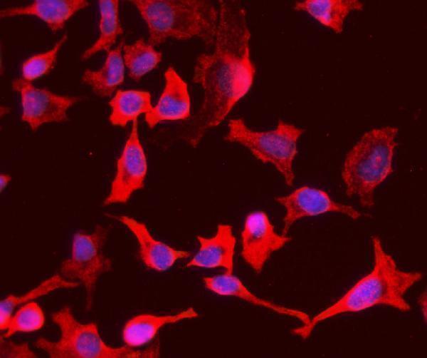 a02022 3 pck1 primary antibodies if testing 4