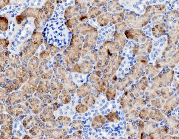 a02022 3 pck1 primary antibodies ihc testing 2