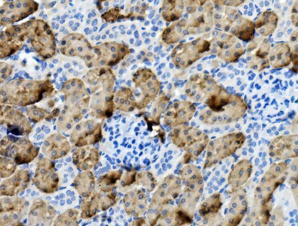 a02022 3 pck1 primary antibodies ihc testing 3