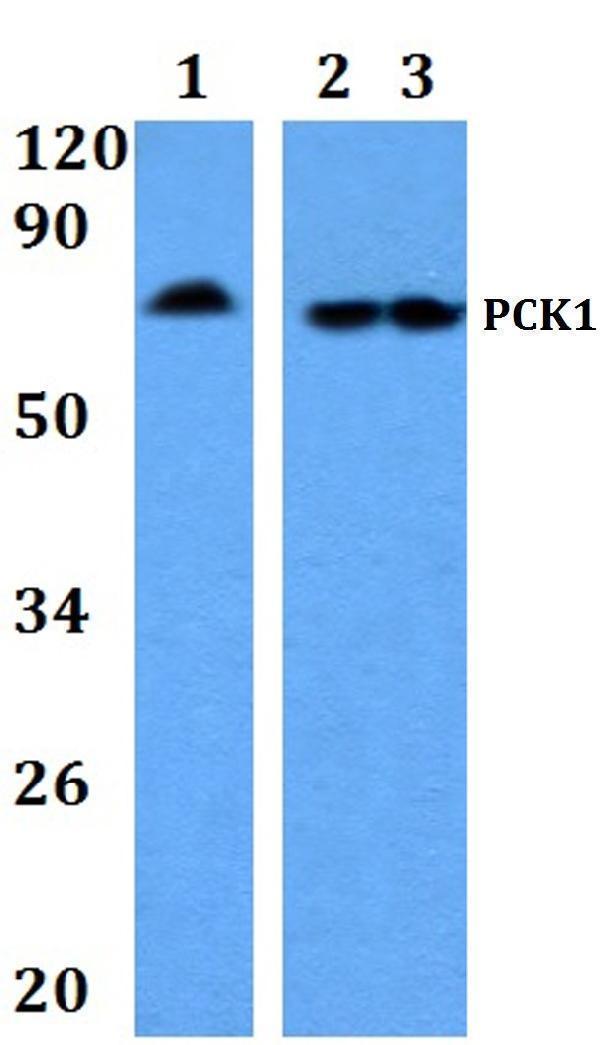 Western blot (WB) analysis of PCK1 polyclonal antibody at 1:500 dilution
Lane1:Hela whole cell lysate
Lane2:Raw264