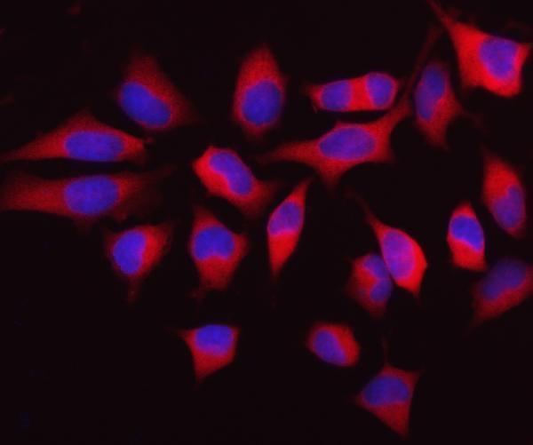 a02025 1 mthfd1 primary antibodies if testing 8