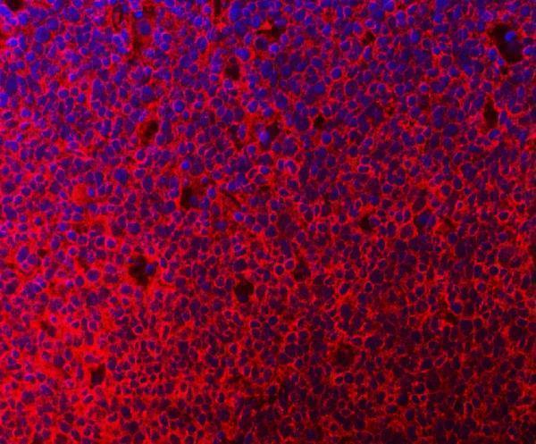 a02025 1 mthfd1 primary antibodies if testing 9