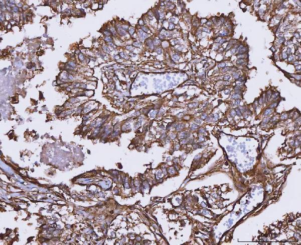  IHC analysis of MTHFD1 using anti-MTHFD1 antibody (A02025-1)