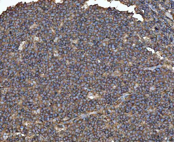  IHC analysis of MTHFD1 using anti-MTHFD1 antibody (A02025-1)