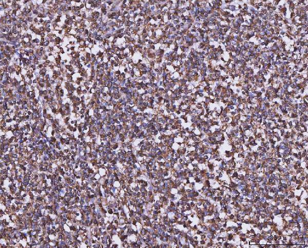 a02025 1 mthfd1 primary antibodies ihc testing 4