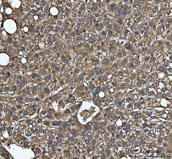 a02025 1 mthfd1 primary antibodies ihc testing 5