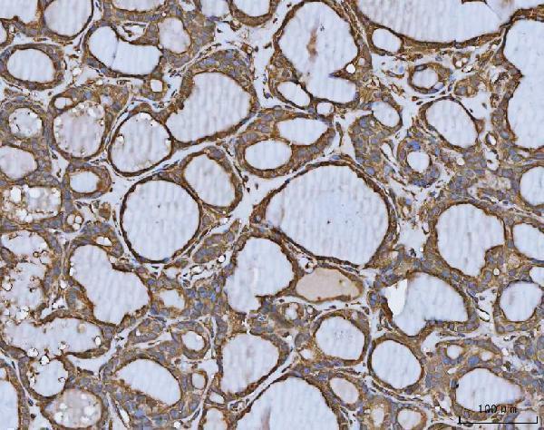 a02025 1 mthfd1 primary antibodies ihc testing 6