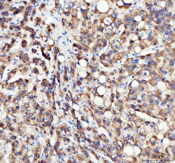  IHC analysis of INSIG1 using anti-INSIG1 antibody (A02026-2)