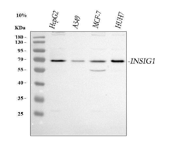  Western blot analysis of INSIG1 using anti-INSIG1 antibody (A02026-2)