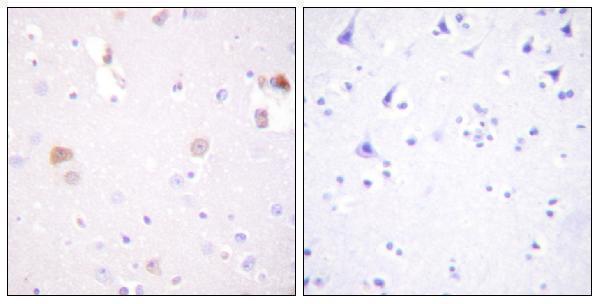 Immunohistochemistry analysis of paraffin-embedded human brain tissue, using PLD1 Antibody