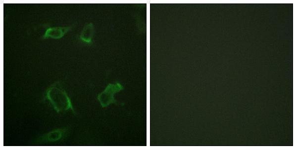 Immunofluorescence analysis of HepG2 cells, using PLD1 (Phospho-Ser561) Antibody