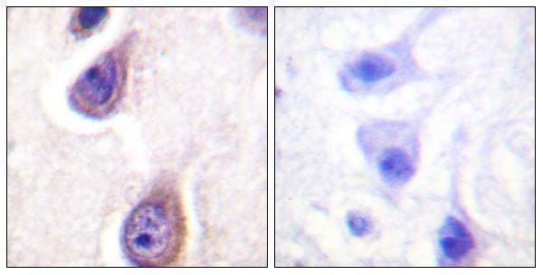 Immunohistochemistry analysis of paraffin-embedded human brain, using PLD1 (Phospho-Ser561) Antibody