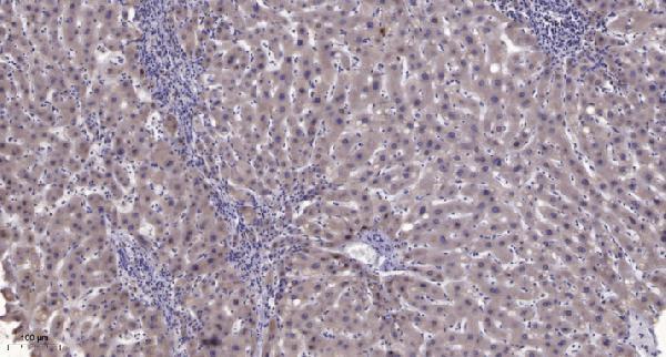a02031t147 pld1 primary antibodies ihc testing 1