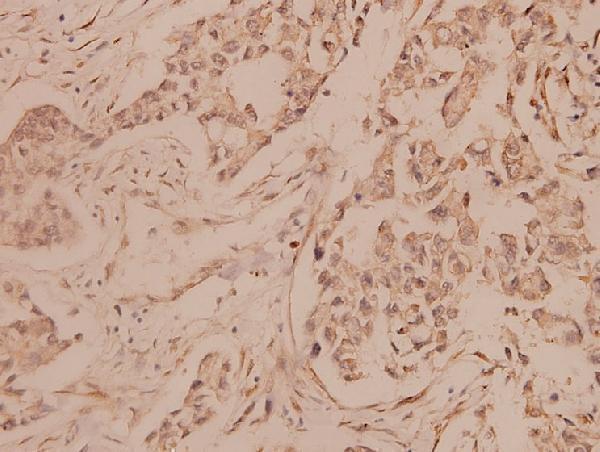 a02033 2 mlana primary antiboties ihc testing 2