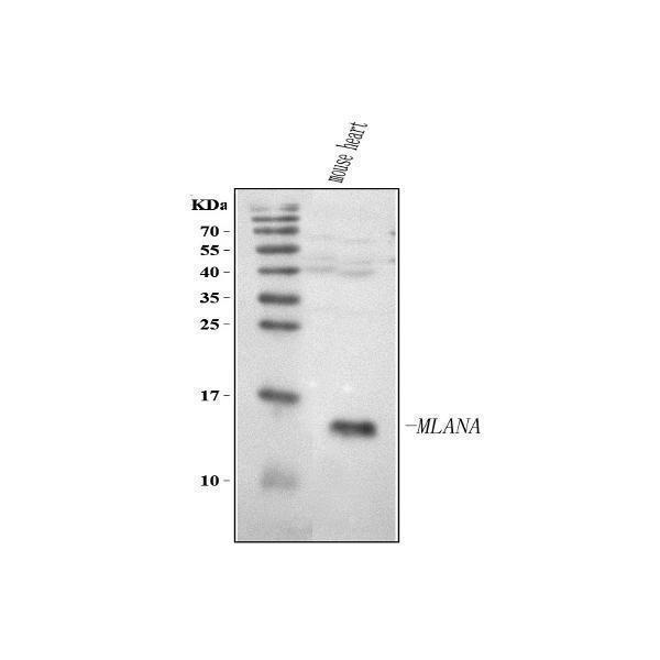  Western blot analysis of Melan-A/MLANA using anti-Melan-A/MLANA antibody (A02033-3)