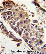 a02034 1 anti serpinf1 antibody center ihc p testing 2
