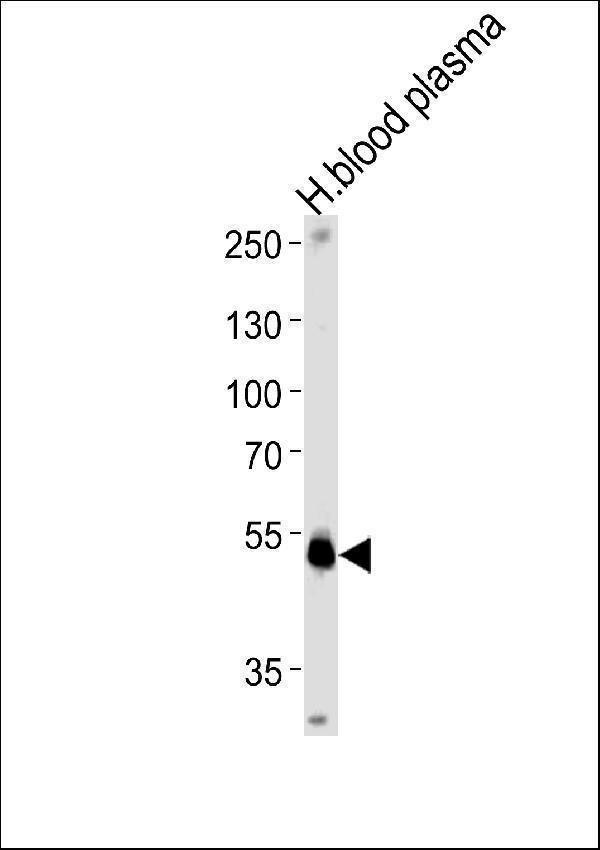 a02034 1 anti serpinf1 antibody center wb testing 1