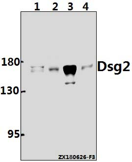 Western blot (WB) analysis of Dsg2 (V440) pAb at 1:1000 dilution
Lane1:Hela whole cell lysate(20ug)
Lane2:The Embryo tissue lysate of Mouse(40ug)
Lane3:SGC7901 whole cell lysate(40ug)
Lane4:PC12 whole cell lysate(40ug)