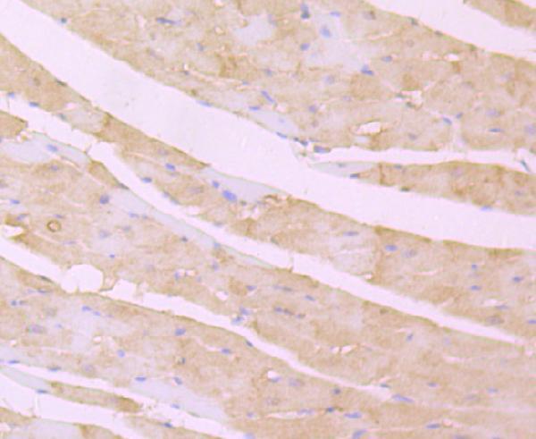 Immunohistochemical analysis of paraffin-embedded rat heart tissue using anti-Desmoglein 2 antibody