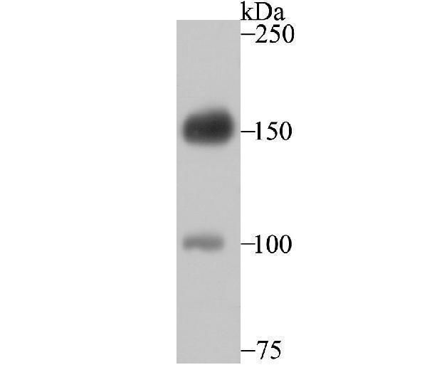 Western blot analysis of Desmoglein 2 on A431 cell using anti-Desmoglein 2 antibody at 1/500 dilution
