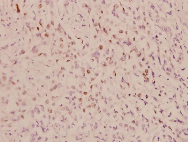 a02038 1 jun primary antiboties ihc testing 2